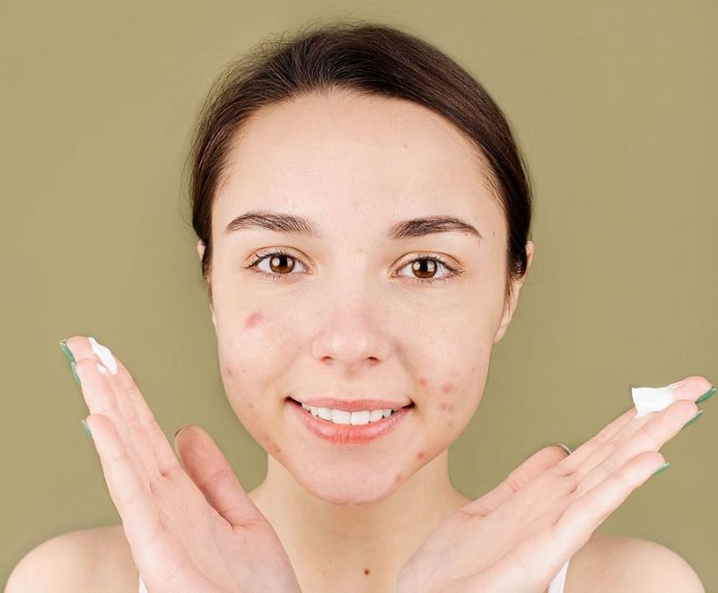 Lợi ích và nhược điểm của phương pháp treatment trị mụn